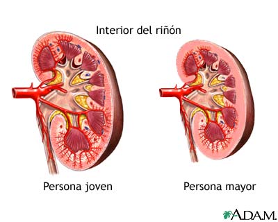 Cambios en el riñón por el envejecimiento Cambios en el riñón por el envejecimiento