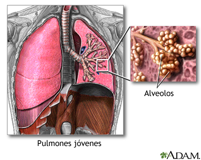 Pulmones y alveolos normales Pulmones y alveolos normales