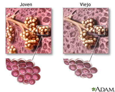 Cambios en el tejido pulmonar por el envejecimiento Cambios en el tejido pulmonar por el envejecimiento