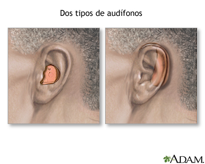 Audífonos Audífonos
