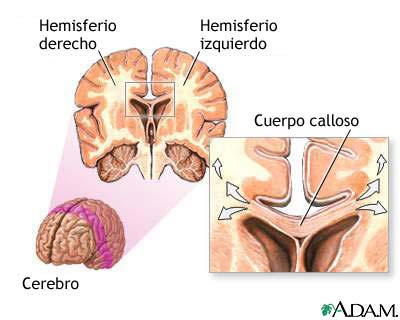 Cuerpo calloso del cerebro Cuerpo calloso del cerebro