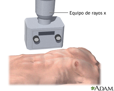 Rayos x