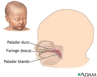 Paladares blando y duro Paladares blando y duro