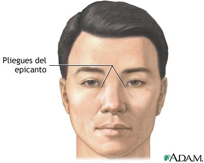 Pliegues del epicanto Pliegues del epicanto