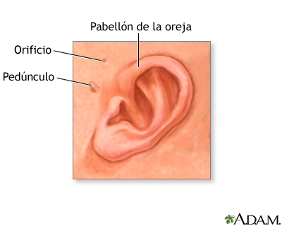 Anatomía de la oreja del recién nacido Anatomía de la oreja del recién nacido