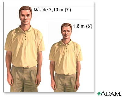 Macrosomía Macrosomía