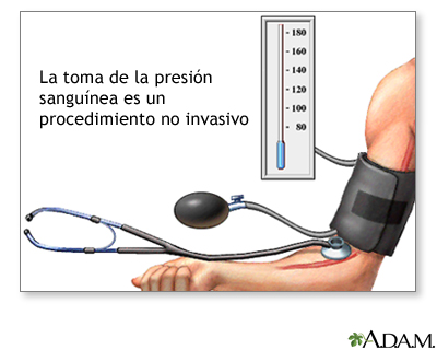 Prueba no invasiva Prueba no invasiva