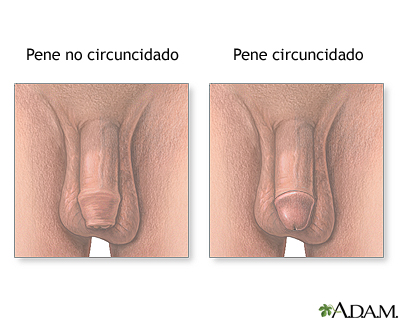 Higiene reproductiva masculina Higiene reproductiva masculina