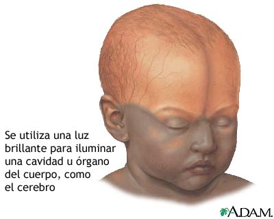 Examen del cerebro del lactante Examen del cerebro del lactante