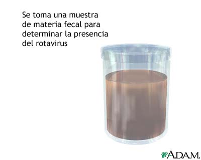 Muestra de heces Muestra de heces