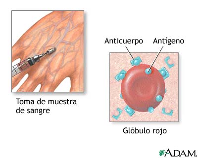 Prueba de sangre para herpes Prueba de sangre para herpes
