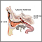 Inserción de un tubo en el oído - serie - Anatomía normal