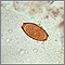 Huevo de Trichuris trichiura