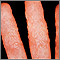 Dermatitis como reacción a la tiña