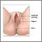 Reparación anterior de la vagina (incontinencia urinaria - tratamiento quirúrgico) - serie