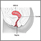 Displasia cervical - serie