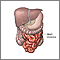 Divertículo de Meckel - anatomía normal