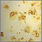 Enfermedad del legionario - organismo Legionella