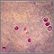 Cryptosporidium