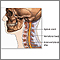 Cirugía de la columna cervical - Serie