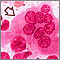 Osteoclasto
