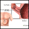 Acalasia - serie