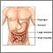Enfermedad inflamatoria intestinal - serie