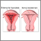 Periodos menstruales anormales