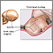 Moldeamiento de la cabeza fetal