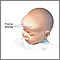 Protuberancia frontal
