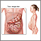 Megacolon tóxico