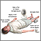 Emergencias por calor