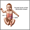 Hepatoesplenomegalia