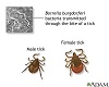 Enfermedad de Lyme terciaria