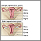 Menopausia