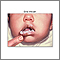 Muguet oral