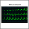 Taquicardia ventricular