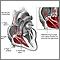 Regurgitación tricuspídea