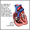 Cor pulmonale