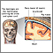 Meninges del cerebro