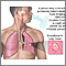 Tuberculosis pulmonar