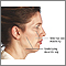 Cirugía estética facial - Serie - Indicaciones