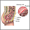 Muestra de vellosidad coriónica - anatomía normal