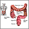 Intestino grueso (colon)