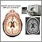 IRM del cerebro