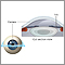 Cirugía ocular con Lasik - serie - Anatomía normal