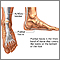 Fascia Plantar