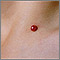 Granuloma piogénico en primer plano