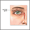 Glándula lacrimal
