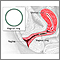 Anillo vaginal